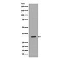 Western blot testing of human Jurkat cell lysate with CD8A antibody. Predicted molecular weight: 26-35 kDa depending on glycosylation level.