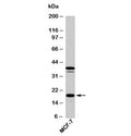 Western blot testing of human samples with AGR2 antibody at 5ug/ml. Expected molecular weight: 17-20 kDa.