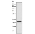 Western blot testing of human HeLa cell lysate with TIMP2 antibody. Predicted molecular weight ~24 kDa.