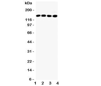 Western blot testing of IRS-1 antibody and Lane 1: HeLa; 2: A549; 3: 293T; 4: MCF-7 lysate, Expected size: 132~185KD depending on serine phosphorylation level