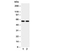 Western blot testing of CYP11A1 antibody and human placenta tissue lysate. Expected molecular weight: 50-60 kDa.