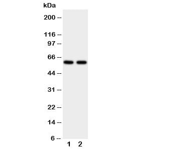 Western blot testing of CYP11A1 antibody and human placenta tissue lysate. Expected molecular weight: 50-60 kDa.