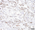 IHC testing of FFPE human kidney transplant tissue (10X) stained with C4d antibody (C4D204).