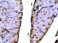 IHC staining of FFPE mouse pancreas tissue with Sox11 antibody. HIER: boil tissue sections in pH8 EDTA for 20 min and allow to cool before testing.