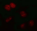 Immunofluorescent staining of FFPE human HeLa cells with PSMB2 antibody (red). HIER: steam section in pH6 citrate buffer for 20 min.