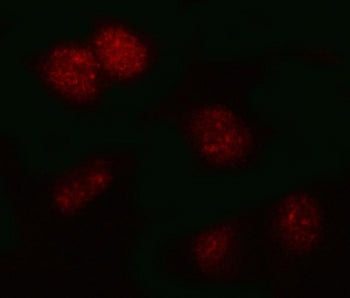 Immunofluorescent staining of FFPE human HeLa cells with PSMB2 antibody (red). HIER: steam section in pH6 citrate buffer for 20 min.