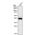 Western blot using the Phospho-p38 (Thr180) antibody and MCF-7 cell lysate shows a predominant band at ~38-40 kDa consistent with p38 alpha, with a faint higher species (~41-42 kDa) attributable to p38 beta or a more highly phosphorylated pool.