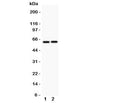 Western blot testing of LTBR antibody and Lane 1: HeLa; 2: A549; Observed size: 45~60KD depending on glycosylation level