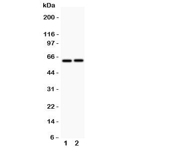 Western blot testing of LTBR antibody and Lane 1: HeLa; 2: A549; Observed size: 45~60KD depending on glycosylation level