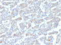 IHC staining of FFPE human liver with APOB antibody. HIER: boil tissue sections in pH 9 10mM Tris with 1mM EDTA for 20 min and allow to cool before testing.
