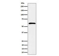 Western blot testing of human K562 cell lysate with SDC3 antibody. Predicted molecular weight ~46 kDa but may be observed at higher molecular weights due to glycosylation.