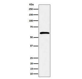 Western blot testing of human K562 cell lysate with SDC3 antibody. Predicted molecular weight ~46 kDa but may be observed at higher molecular weights due to glycosylation.