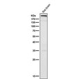Rat brain tissue lysate tested with the MTOR antibody at 1:500 dilution for 1 hour at room temperature. Predicted molecular weight ~289 kDa.