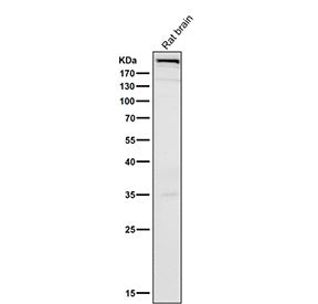 Rat brain tissue lysate tested with the MTOR antibody at 1:500 dilution for 1 hour at room temperature. Predicted molecular weight ~289 kDa.