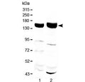 Western blot testing of 1) rat liver and 2) mouse liver with Xanthine Oxidase antibody at 0.5ug/ml. Predicted molecular weight ~146 kDa.