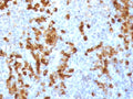 IHC staining of FFPE human tonsil tissue with recombinant Kappa light chain antibody (clone KC3L-3R). Required HIER: boil tissue sections in pH6, 10mM citrate buffer, for 10-20 min followed by cooling at RT for 20 min.