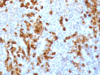 IHC staining of FFPE human tonsil tissue with recombinant Kappa light chain antibody (clone KC3L-3R). Required HIER: boil tissue sections in pH6, 10mM citrate buffer, for 10-20 min followed by cooling at RT for 20 min.