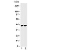 Western blot testing of Cdk6 antibody and Lane 1: rat testis; 2: (r) lung tissue lysate. Predicted molecular weight: 36-40 kDa.
