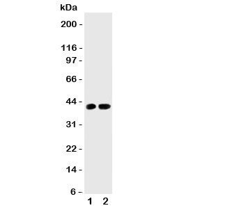 Western blot testing of Cdk6 antibody and Lane 1: rat testis; 2: (r) lung tissue lysate. Predicted molecular weight: 36-40 kDa.