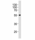 Western blot analysis of lysate from WiDr cell line using PDX1 at 1:1000. Predicted molecular weight ~54kDa.