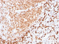 IHC testing of FFPE human tonsil with recombinant TCL1 antibody. HIER: boil tissue sections in pH 9 10mM Tris with 1mM EDTA for 10-20 min followed by cooling at RT for 20 min.