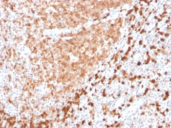 IHC testing of FFPE human tonsil with recombinant TCL1 antibody. HIER: boil tissue sections in pH 9 10mM Tris with 1mM EDTA for 10-20 min followed by cooling at RT for 20 min.