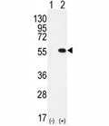 Western blot analysis of PRMT2 antibody and 293 cell lysate either nontransfected (Lane 1) or transiently transfected (2) with the PRMT2 gene.