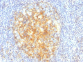IHC: Formalin-fixed, paraffin-embedded human tonsil stained with VCAM1 antibody (VCAM1/843).