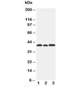 Western blot testing of CCR5 antibody and Lane 1: mouse lung; 2: mouse intestine; 3: mouse kidney. Predicted molecular weight ~41 kDa.