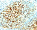 IHC analysis of formalin-fixed, paraffin-embedded human tonsil stained with VCAM-1 antibody (clone 1.4C3).