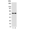 Western blot testing of VDR antibody and Lane 1: MCF-7; 2: HeLa cell lysate. Predicted molecular weight 48/54 kDa (isoforms 1/2).