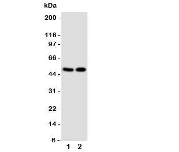 Western blot testing of VDR antibody and Lane 1: MCF-7; 2: HeLa cell lysate. Predicted molecular weight 48/54 kDa (isoforms 1/2).