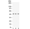 Western blot testing of 1) rat liver, 2) mouse spleen and 3) human HeLa cell lysate with hnRNP F antibody at 0.5ug/ml. Predicted molecular weight ~46 kDa.