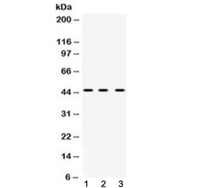Western blot testing of 1) rat liver, 2) mouse spleen and 3) human HeLa cell lysate with hnRNP F antibody at 0.5ug/ml. Predicted molecular weight ~46 kDa.
