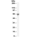 Western blot testing of human umbilical cord lysate with FOXO1 antibody at 0.1ug/ml. Predicted molecular weight ~70kDa.