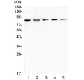 Western blot testing of human 1) HeLa, 2) 293T, 3) COLO-320, 4) SW620 and 5) MCF7 cell lysate with RNF43 antibody at 0.5ug/ml. Predicted molecular weight: ~86 kDa (isoform 1), ~95 kDa (isoform 4).