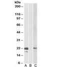 Western blot testing of HEK293 lysate overexpressing human CST8-MYC probed with Cystatin 8 antibody [0.3ug/ml] in Lane A and anti-MYC [1/1000] in lane C. Mock-transfected HEK294 probed with Cystatin 8 antibody [1ug/ml] in Lane B.