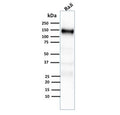 Western blot testing of human Raji cell lysate with CD21 antibody (clone CR2/2754).