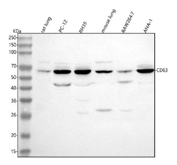 Western blot analysis of Cd63 using anti-Cd63 antibody. Lane 1: rat lung tissue lysates, Lane 2: rat PC-12 whole cell lysates, Lane 3: rat RH35 whole cell lysates, Lane 4: mouse lung tissue lysates, Lane 5: mouse RAW264.7 whole cell lysates, Lane 6: mouse ANA-1 whole cell lysates. After electrophoresis, proteins were transferred to a nitrocellulose membrane at 150 mA for 50-90 min. Blocked the membrane with 5% non-fat milk/TBS for 1.5 hour at RT.