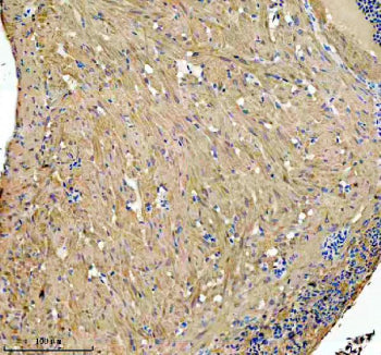 IHC staining of FFPE zebrafish brain tissue with Zebrafish Glud1 antibody, HRP secondary and DAB substrate. HIER: boil tissue sections in pH8 EDTA for 20 min and allow to cool before testing.