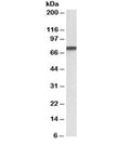 Western blot testing of A431 lysate with Progranulin antibody at 1ug/ml. Predicted molecular weight: 64/70~88kDa (unmodified/glycosylated), observed here at ~75kDa.