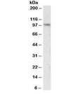Western blot testing of nuclear Jurkat lysate with UHRF1 antibody at 2ug/ml. Predicted/observed molecular weight: ~91/91-106kDa.