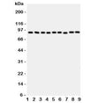Western blot testing of VCP antibody and rat samples 1: brain; 2: kidney; 3: liver; 4: lung; and human samples 5: HeLa; 6: HL-60; 7: A431; 8: A549; 9: SMMC-7721 cell lysate. Predicted/observed molecular weight: ~89/97 kDa.