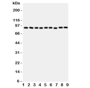 Western blot testing of VCP antibody and rat samples 1: brain; 2: kidney; 3: liver; 4: lung; and human samples 5: HeLa; 6: HL-60; 7: A431; 8: A549; 9: SMMC-7721 cell lysate. Predicted/observed molecular weight: ~89/97 kDa.