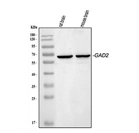 Western blot testing of 1) rat brain and 2) mouse brain lysate with GAD65 antibody at 0.5ug/ml. Predicted molecular weight ~65 kDa.