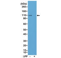 Western blot testing of lysate from mouse brain tissue, untreated (-) or dephosphorylated (+) with Lambda Protein Phosphatase (lambdaPP), with recombinant phospho-GluR1 antibody at 1:200 dilution. Predicted molecular weight ~102 kDa.