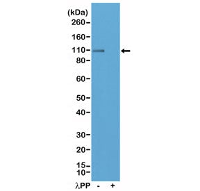 Western blot testing of lysate from mouse brain tissue, untreated (-) or dephosphorylated (+) with Lambda Protein Phosphatase (lambdaPP), with recombinant phospho-GluR1 antibody at 1:200 dilution. Predicted molecular weight ~102 kDa.