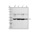 Western blot analysis of SMYD5 using anti-SMYD5 antibody. Electrophoresis was performed on a 10% SDS-PAGE gel at 80V (Stacking gel) / 120V (Resolving gel) for 2 hours. Lane 1: human HepG2 whole cell lysates, Lane 2: human whole cell lysates, Lane 3: human Caco-2 whole cell lysates, Lane 4: human U2OS whole cell lysates. After electrophoresis, proteins were transferred to a nitrocellulose membrane at 150 mA for 50-90 min. Blocked the membrane with 5% non-fat milk/TBS for 1.5 hour at RT.