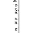 Western blot analysis of GLUT2 antibody and HepG2 lysate. Expected molecular weight: 57~70 kDa depending on glycosylation level.
