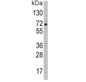 Western blot analysis of GLUT2 antibody and HepG2 lysate. Expected molecular weight: 57~70 kDa depending on glycosylation level.